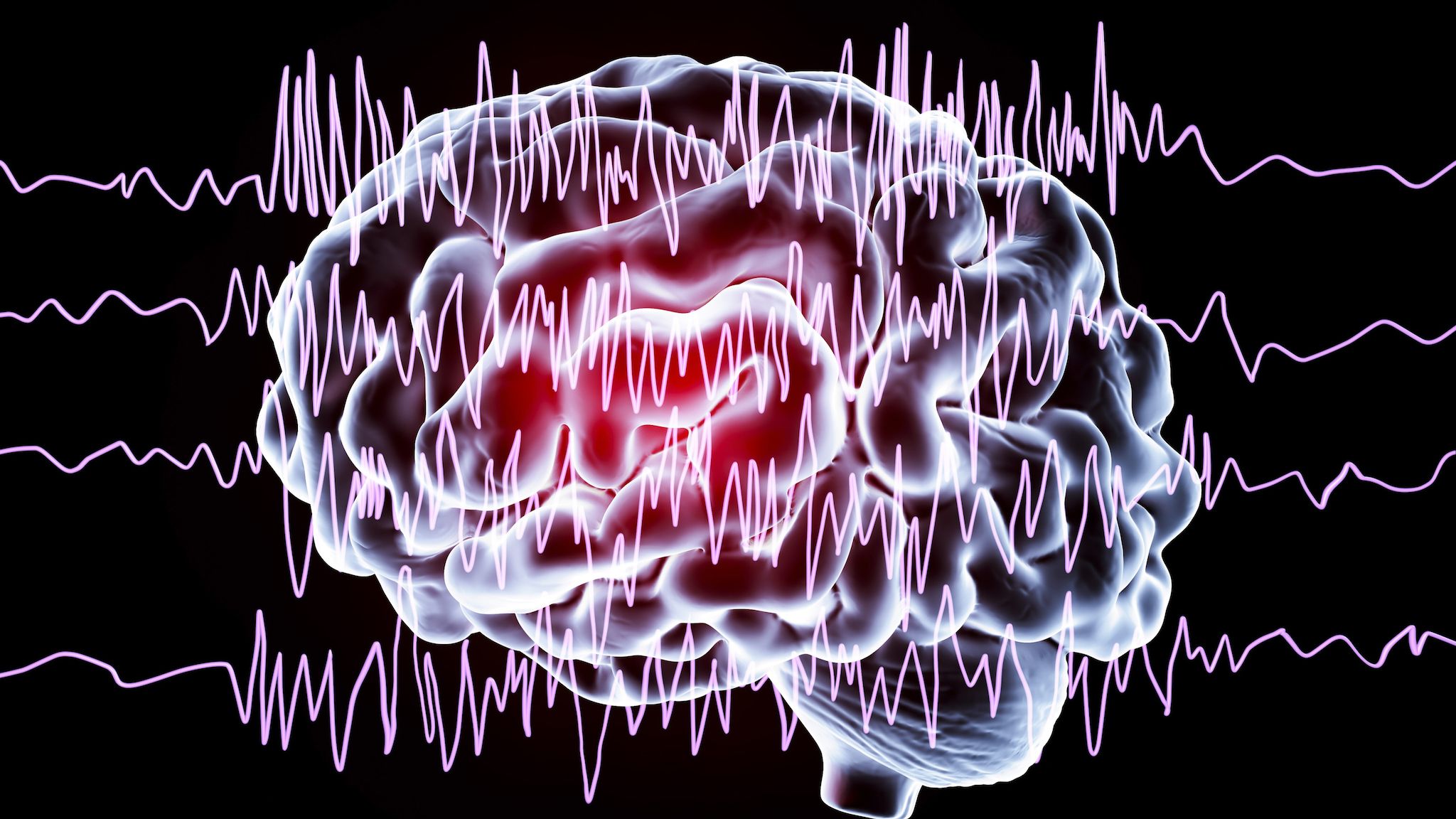 Engineer finds his smart sleep mask can read other people's brainwaves due to poor software security — superpower granted via poor-quality software with hardcod